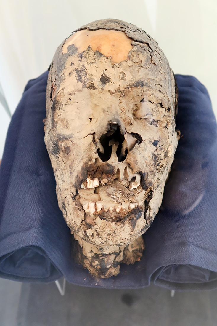 geneeskundemuseum brussel 8-2025 3137