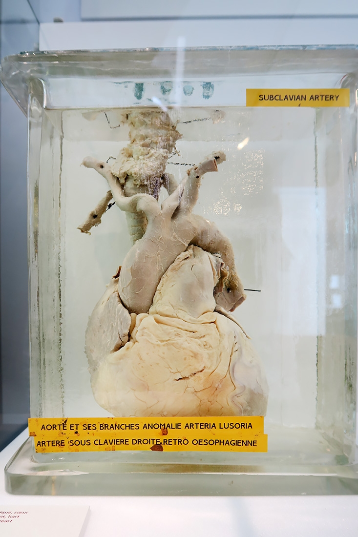 geneeskundemuseum brussel 8-2025 3140