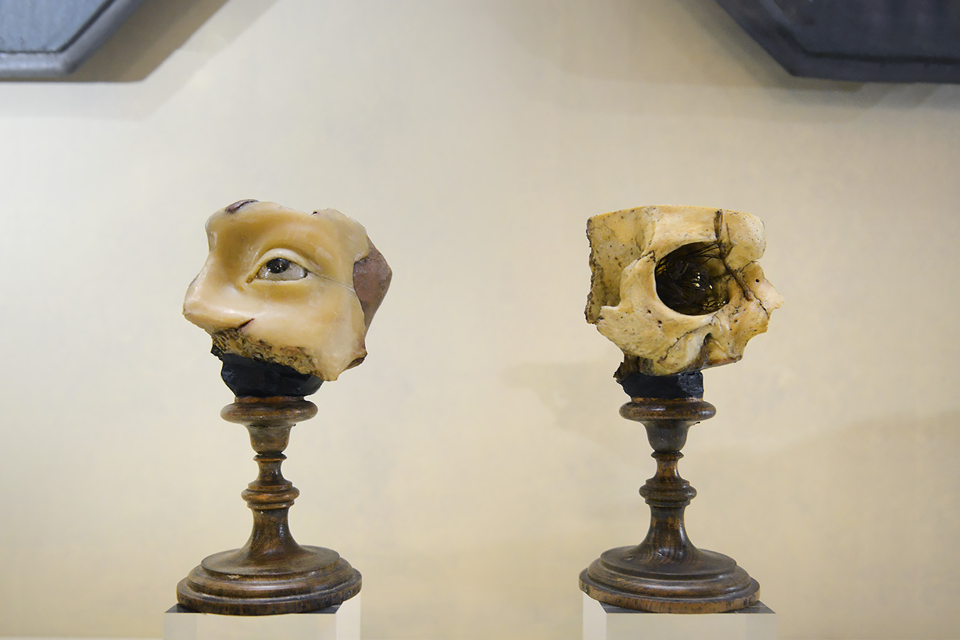 museo di anatomia umana bologna 8-2022 4760