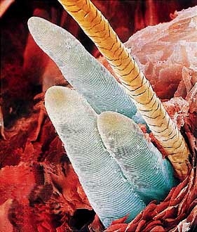 demodex folliculorum