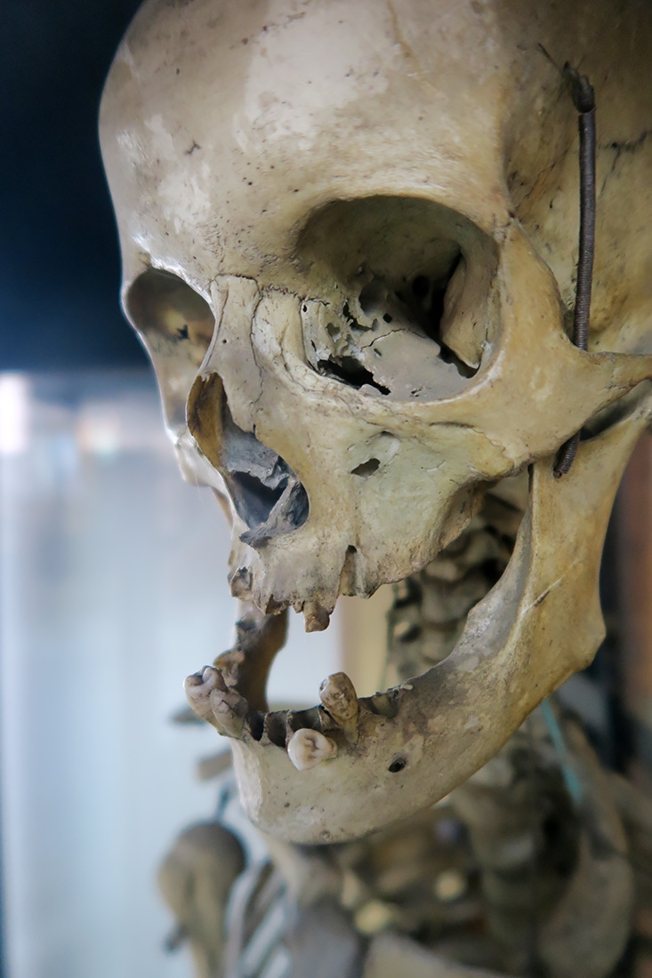 geneeskundemuseum brussel 8-2025 3078