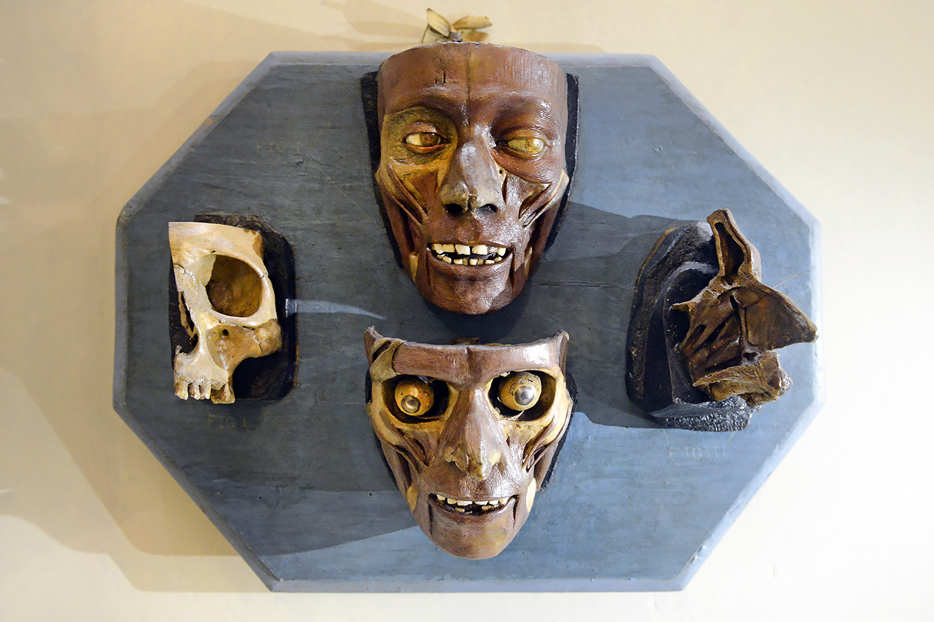 museo di anatomia umana bologna 8-2022 4763