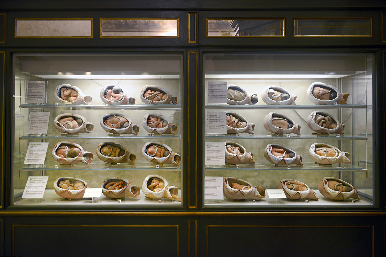 museo ostetrico giovan antonio galli bologna 8-2022 4038