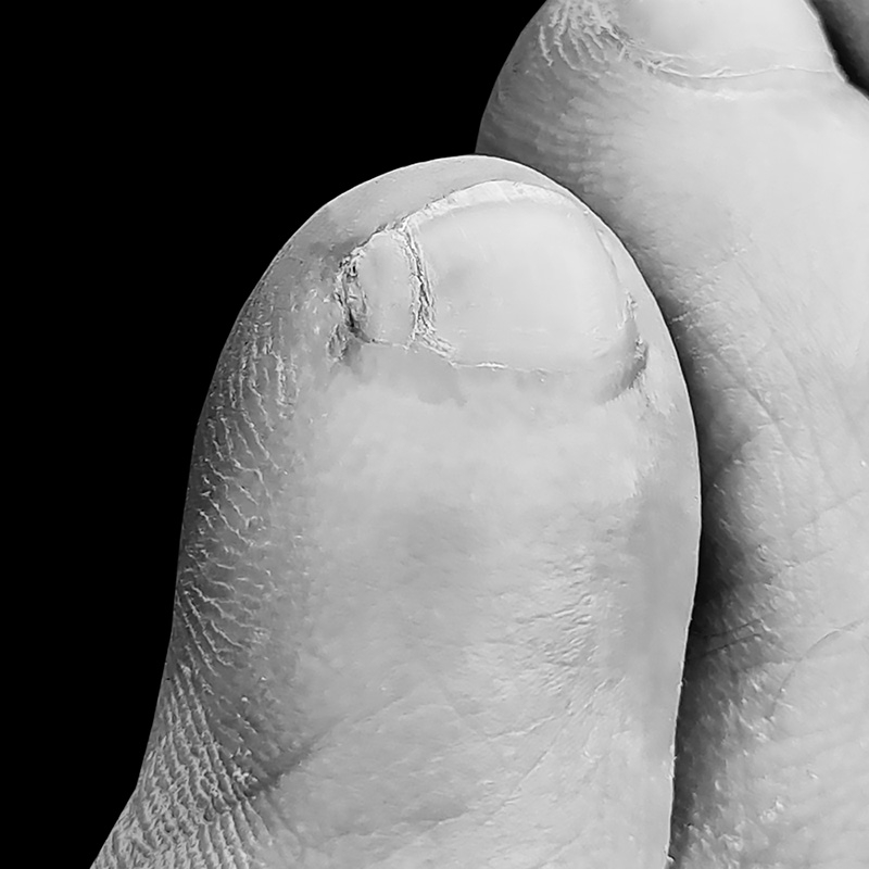 zesde teennagel 7-2025 184251